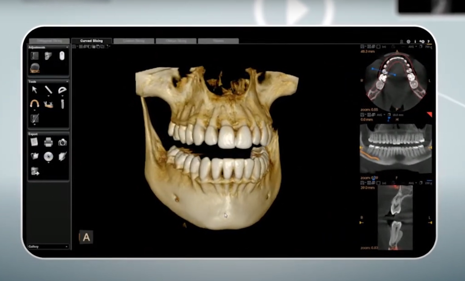 CBCT & OPG Dublin